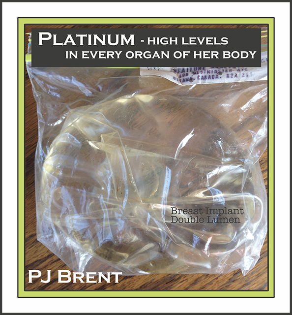 This image has an empty alt attribute; its file name is pj-brent-platinum-implant-collage-rs2.jpg